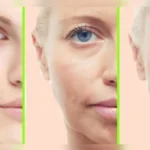 Skin Tightening Tips: ढीली पड़ती त्वचा से हैं परेशान? महंगे फेशियल छोड़ें, आज से ही अपनाएं ये 7 घरेलू आदतें