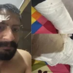 Yamunanagar crime news: जमानत पर बाहर आए हत्या के आरोपी को कार से घेरकर पीटा, लोहे की रॉड से हमला