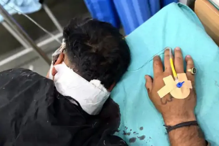 रेवाड़ी में रोड रेज का खौफनाक अंत: स्कूटी-ऑटो की टक्कर के बाद फोटोग्राफर की गर्दन रेती, हालत गंभीर