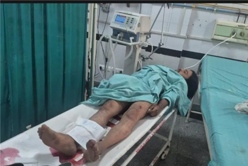  नूंह मुठभेड़: पुलिस की जवाबी फायरिंग में 2 गो-तस्करों को लगी गोली, पहाड़ों में छिपे थे बदमाश