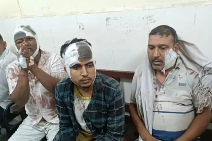 गंदे पानी की निकासी को लेकर टयोंठा में खूनी संघर्ष, लाठी-गंडासियों से हमला; 6 महिलाओं समेत 12 पर केस