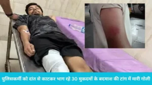 Kurukshetra Police Encounter: पुलिसकर्मी को दांत से काटकर भाग रहे 30 मुकदमों के बदमाश की टांग में मारी गोली