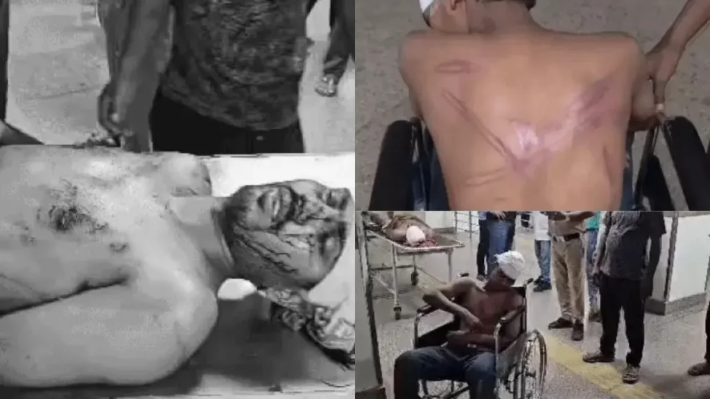 Yamunanagar Crime News: यमुनानगर में खूनी खेल, 15 युवकों ने घर में घुसकर सो रहे दो भाइयों को रॉड से पीटा