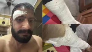 Yamunanagar crime news: जमानत पर बाहर आए हत्या के आरोपी को कार से घेरकर पीटा, लोहे की रॉड से हमला