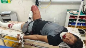 Ambala News Update: अंबाला-दिल्ली हाईवे पर पति का हाईवोल्टेज ड्रामा, पत्नी से विवाद के बाद ट्रक के आगे कूदा, अस्पताल में कैंची से हमले का प्रयास