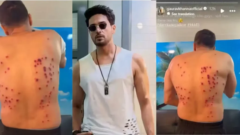 Gaurav Khanna kkk15: स्टंट के दौरान पैलेट गन से छलनी हुए गौरव खन्ना, पीठ के जख्म देख सहमे फैंस