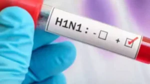 Haryana Swine Flu: स्वाइन फ्लू के नाम से न डरें, हरियाणा स्वास्थ्य विभाग ने जारी की नई एडवाइजरी