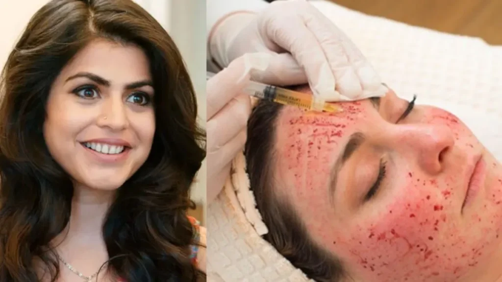 Vampire Facial Benefits Process: खूबसूरत त्वचा के लिए खून से फेशियल! शहनाज ट्रेजरी ने करवाया वैम्पायर फेशियल, जानिए पूरा प्रोसेस