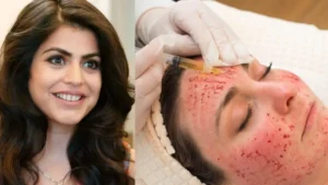 Vampire Facial Benefits Process: खूबसूरत त्वचा के लिए खून से फेशियल! शहनाज ट्रेजरी ने करवाया वैम्पायर फेशियल, जानिए पूरा प्रोसेस