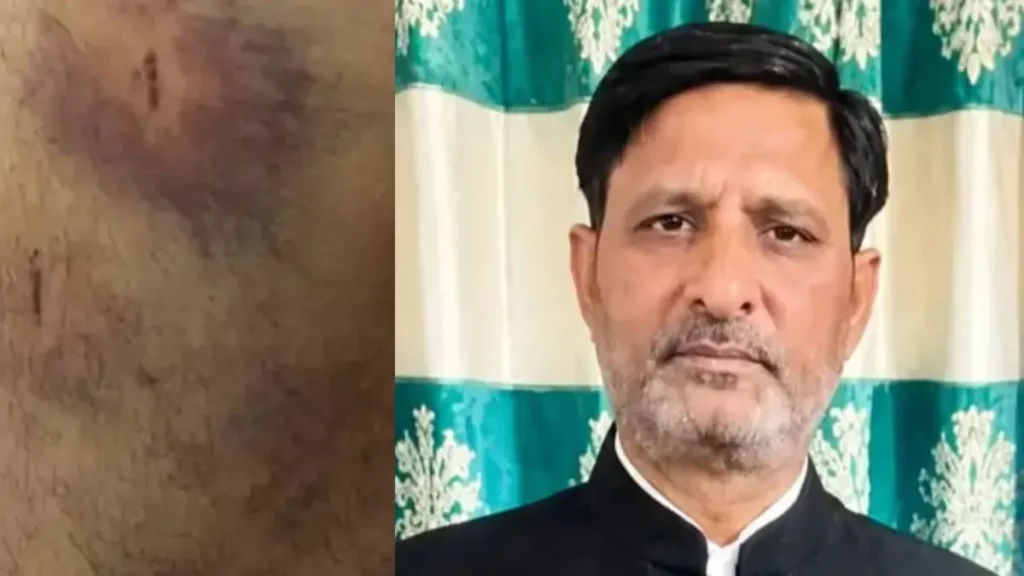 Yamunanagar News: यमुनानगर में प्राइवेट बस वालों की गुंडागर्दी, 3 साल पुराना फर्जी टिकट थमाया, विरोध करने पर कांग्रेस नेता को पीटा