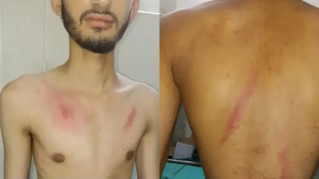 Bhiwani News: भिवानी में 12वीं के छात्र का अपहरण, लोहे की रॉड से पीट-पीटकर किया अधमरा