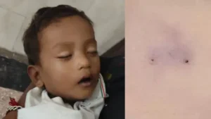 Kurukshetra Snake Bite: कुरुक्षेत्र में पोल्ट्री फार्म के बाहर खेल रहे 19 महीने के मासूम को सांप ने डसा, मौत