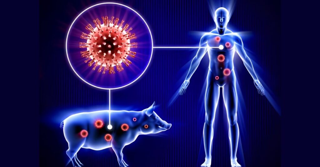 Pathankot Swine Flu : पठानकोट में स्वाइन फ्लू का पहला केस मिलने से हड़कंप