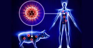 Pathankot Swine Flu : पठानकोट में स्वाइन फ्लू का पहला केस मिलने से हड़कंप