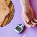 Diabetes Wound Healing Care: डायबिटीज में छोटी सी चोट भी क्यों बन जाती है जानलेवा? जानें एक्सपर्ट डॉक्टर की चेतावनी